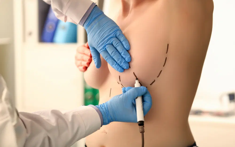 breast augmentation side effects